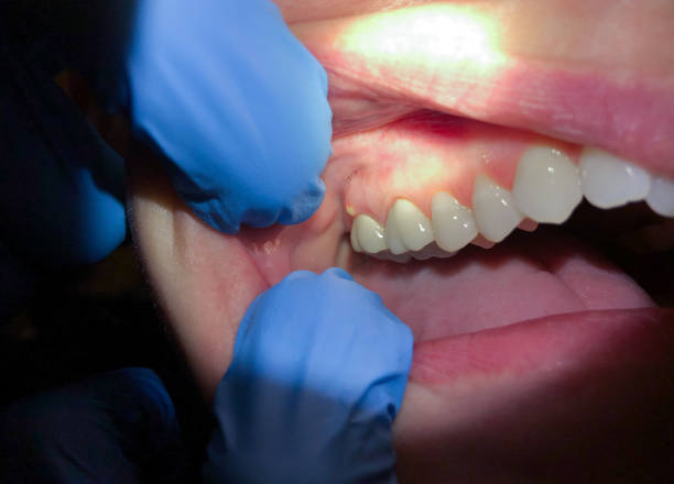 Best Weekend Emergency Dentist in Monrovia, IN