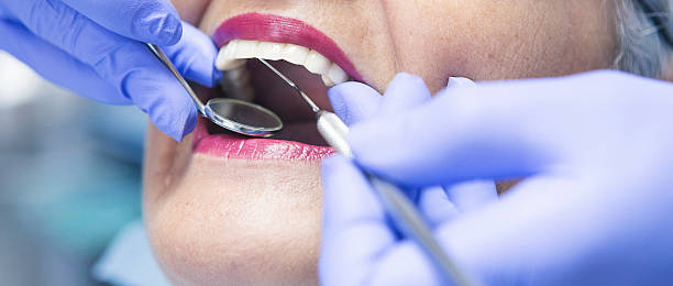 Best Emergency Dental Extractions in Monrovia, IN